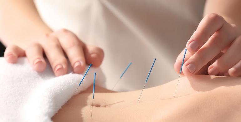 Pratique de l'acupuncture