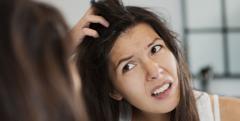 cheveux pellicules