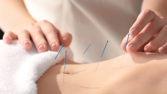 Pratique de l'acupuncture