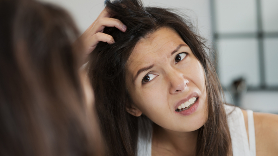 cheveux pellicules